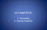 12 Lead ECG. 1.Recording. 2.Normal Features.. Aims and Objectives. Review and perform correct technique to record a 12 lead ECG. To understand related.