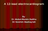 A 12-lead electrocardiogram By Dr Abdul-Monim Batiha Dr Ibrahim Bashayreh.