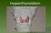 Hyperthyroidism. Defintion TTTTHYROTOXICOSIS IIIIncreased thyroid hormone levels with biological effects on tissues and systems HHHHYPERTIROIDISM.