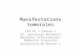 Manifestations tumorales VIH et « Cancer » Pr. Christian MICHELET Maladies Infectieuses, Médecine tropicale Université de Rennes 1.