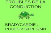 TROUBLES DE LA CONDUCTION BRADYCARDIE : POULS < 50 PLS/MN.