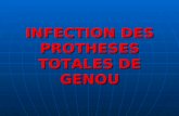INFECTION DES PROTHESES TOTALES DE GENOU. Infection : la principale complication de larthroplastie Infection : la principale complication de larthroplastie.