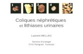 Coliques néphrétiques et lithiases urinaires Laurent BELLEC Service dUrologie CHU Rangueil, Toulouse.