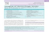 Imaging of Hemorrhagic Stroke