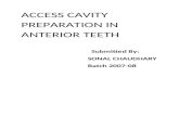 Access Cavity Preparation in Anterior Teeth