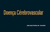 João José Freitas de Carvalho. AVC hemorrágico 1761 - primeira descrição Morgagni GB. De sedibus, et causis morborum per anatomen indagatis libri quinque.