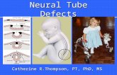 Neural Tube Defect Powerpoint 2004