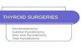 Thyroid Surgeries