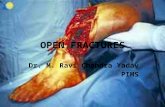 Open fractures
