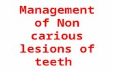 Management of non carious lesions- attrion, abrasion, erosion, abfraction