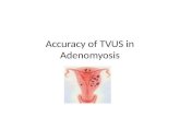 Accuracy of ultrasound sonography in adenomyosis
