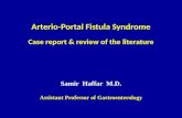 Arterio-Portal Fistula Syndrome (APFS)