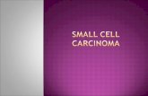 Small cell carcinoma