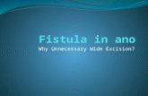 Why Unnecessary Wide Excision in Fistula in ano?