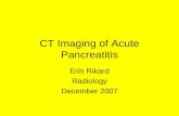 CT Imagine of Acute Pancreatitis