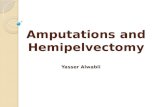 Amputations and hemipelvictomy