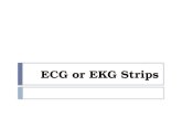 Ecg or ekg sample strips (MS Cardiovascular)