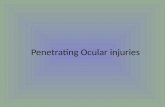Penetrating Ocular Injuries