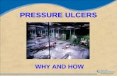 Pressure ulcers, why and how