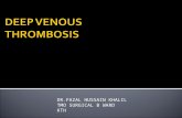 Dvt Deep Venous Thrombosis