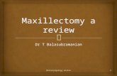 Maxillectomy a review