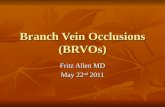 BRANCH RETINAL VEIN OCCLUSION by  Fritz Allen MD COPE ID 31524-CL