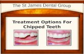 Treatment Options For Chipped Teeth