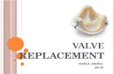 prosthetic valve replacement