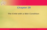 Ppt chapter 29 skin dz peds