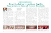 Bone Sculpting to Achieve Papilla Regeneration Around Dental ...