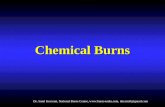 Burns- chemical and pediatric by Dr. Sunil Keswani, National Burns Centre, Airoli