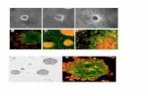 ARTICLE : Screening candidate metastasis-associated genes in three-dimensional HCC spheroids with different metastasis potential