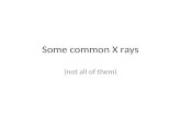 Some common x rays