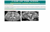 Case of the week cumulative publication: Wilson disease