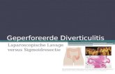 Geperforeerde Diverticulitis Laparoscopische Lavage versus Sigmoidresectie.