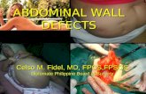 abdominal wall