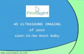 4D Ultrasound of babies