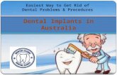 Dental implants in australia
