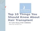 10 Things To Know About Hair Transplant