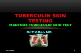 Tuberculin testing