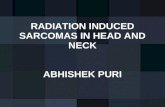 Radiation induced sarcomas in head and neck