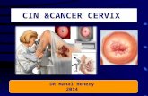 Cin&cancer cervix undergraduate