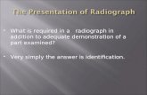 The presentation of radiograph