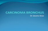 Carcinoma bronchus