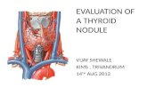 Evaluation of a thyroid nodule by vijay