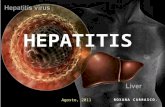 Hepatitis y encefalopatia hepatic amodificado