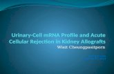Journal Club- Urinary cell mRNA profile and acute cellular rejection