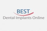 Dental implant procedure - Welcome