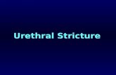 Uro   Urethral Stricture