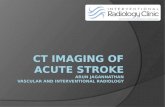 C T  Imaging Of Acute Stroke